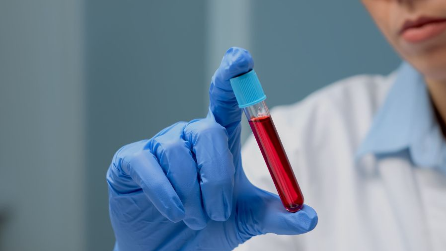 bone marrow transplant can cure complex blood diseases bone marrow transplant can cure complex blood diseases